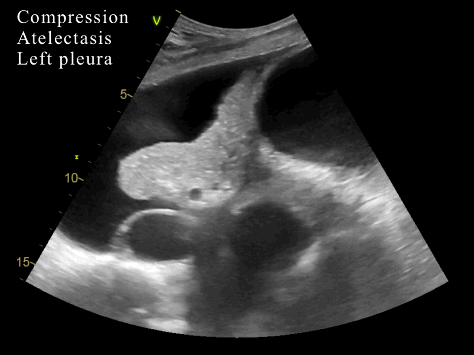 EEU case image missing